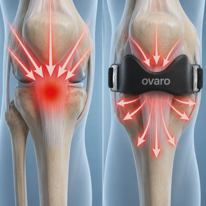 Ovaro Precision Knee Strap